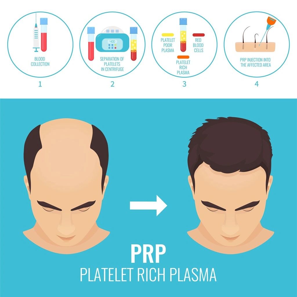 the prp controversy when your hair patience are thinning