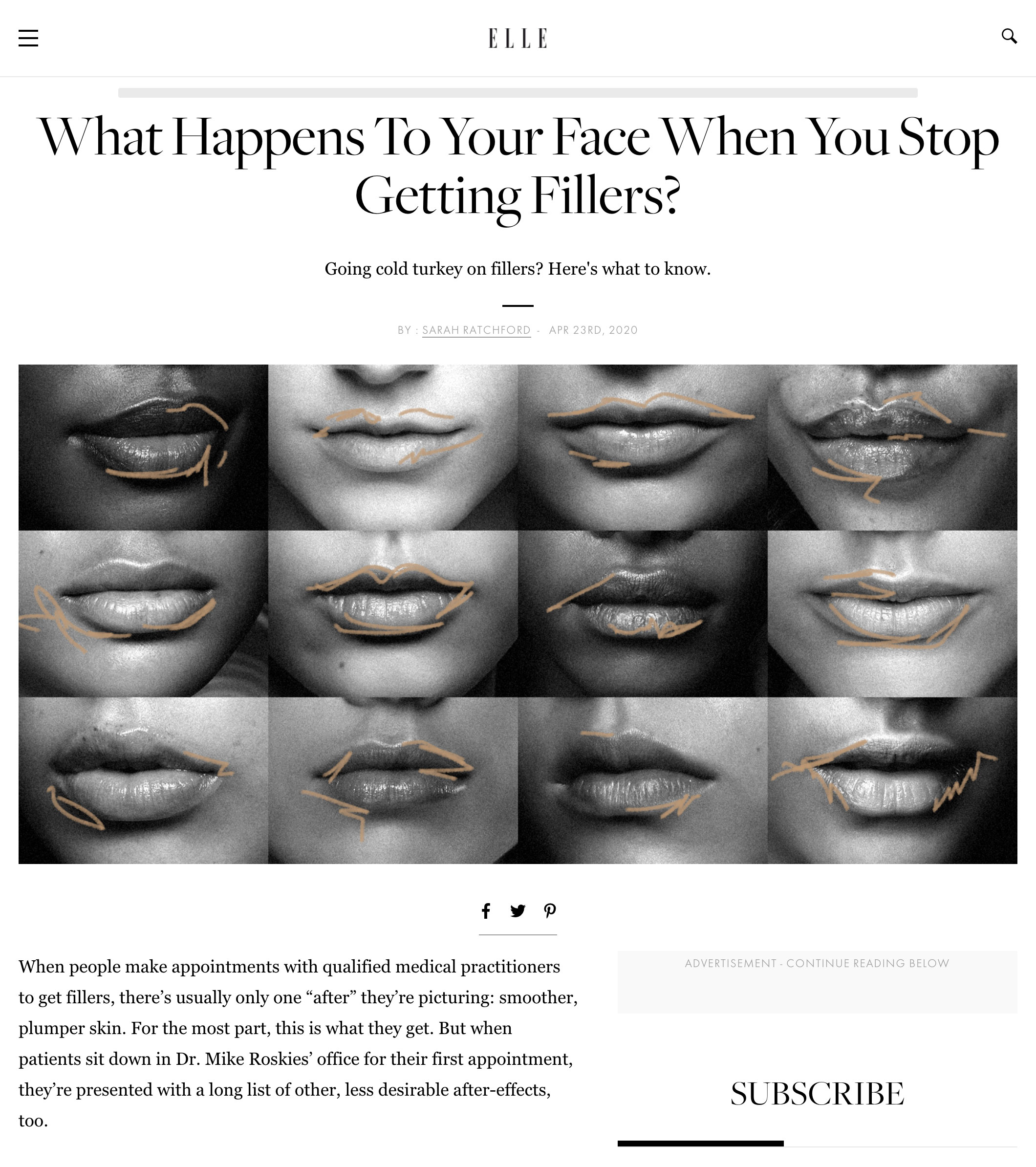 What happens to your face when you stop getting fillers blog